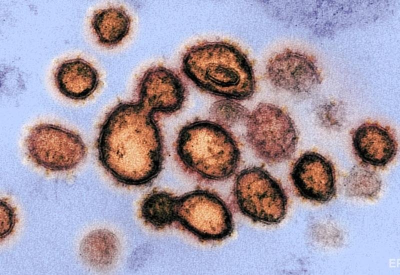 В США рассказали, на каких поверхностях дольше живет коронавирус