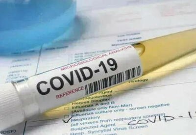 В Азербайджане выявлено еще 2674 случая заражения коронавирусом - СТАТИСТИКА