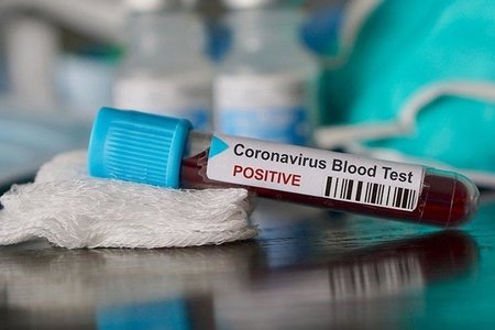 Koronavirusa yoluxanların sayı 1,3 milyonu ötdü