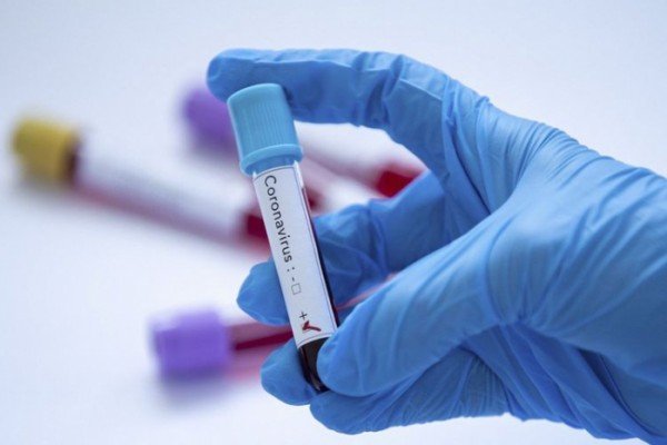 ABŞ-da koronavirusdan ölənlərin sayı 25 mini keçdi