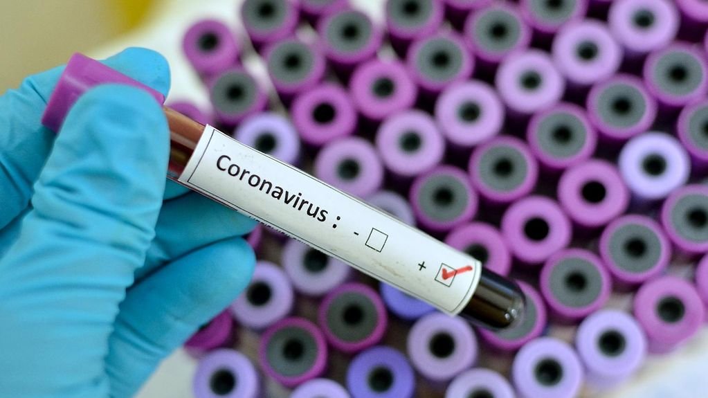 Azərbaycanda daha 39 nəfər koronavirusa yoluxdu, 59 nəfər sağaldı Azərbaycanda daha 39 nəfər koronavirusa yoluxdu, 59 nəfər sağaldı