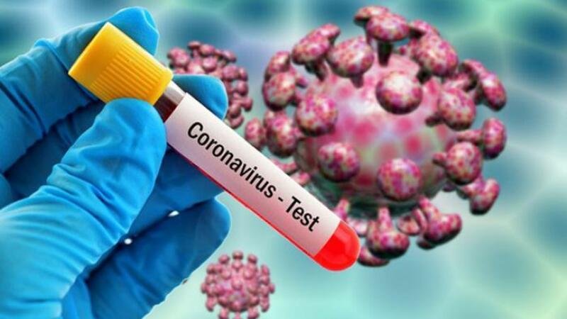 Ermənistanda 74 nəfər koronavirusdan öldü