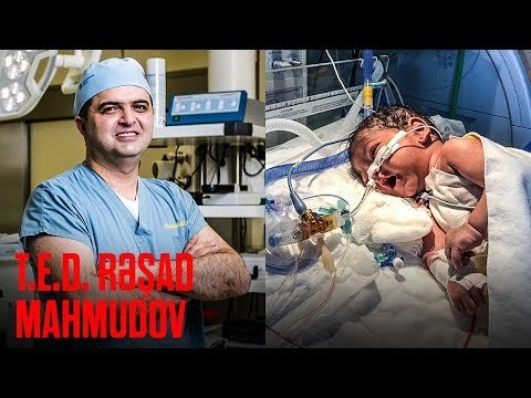 Rəşad Mahmudov daun sindromlu körpə üzərində əməliyyat icra edib - Video
