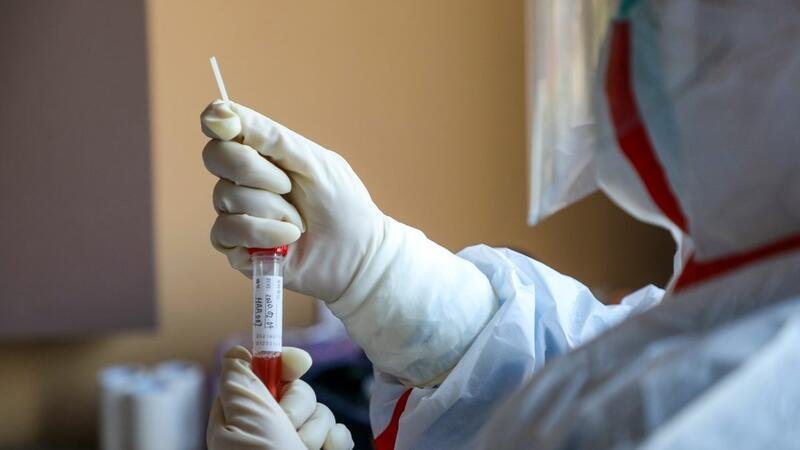 Rusiyada daha 73 nəfər koronavirusdan öldü