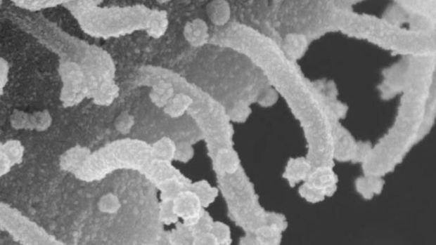 Koronavirus hüceyrəsinin yeni görüntüləri: Təcavüzkar və “zombi”