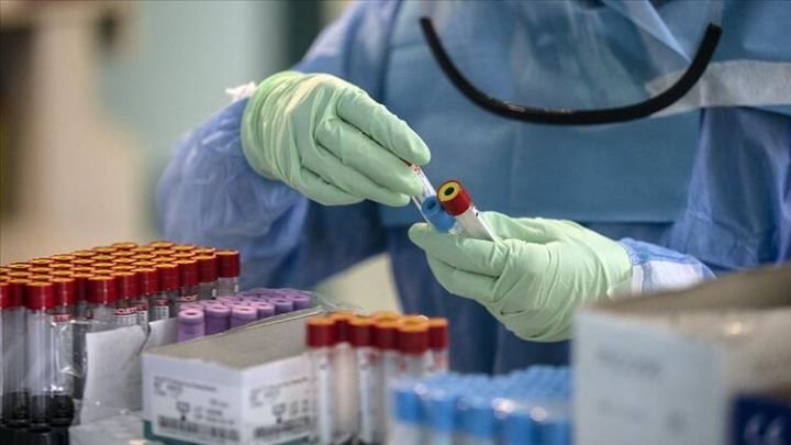 Rusiyada koronavirus üçün peyvəndin ilk sınağı başa çatdı Rusiyada koronavirus üçün peyvəndin ilk sınağı başa çatdı