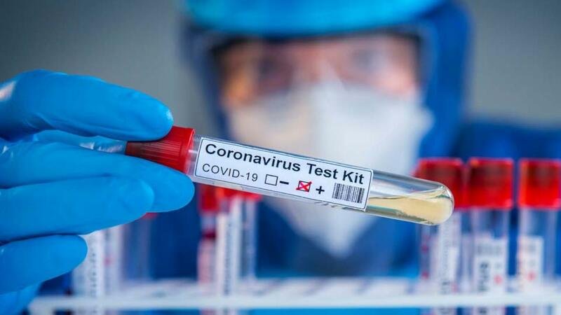 Azərbaycanda koronavirusa yoluxma kəskin artdı