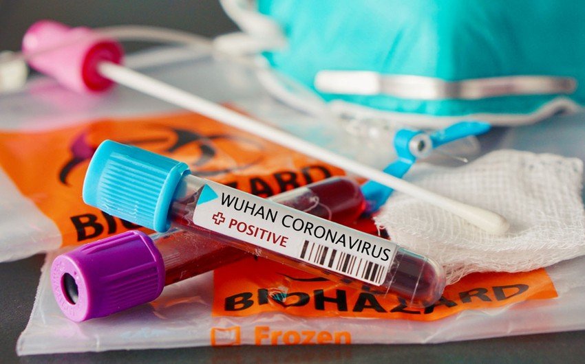 Azərbaycanda daha 4129 nəfər koronavirusa yoluxub, 20 nəfər ölüb