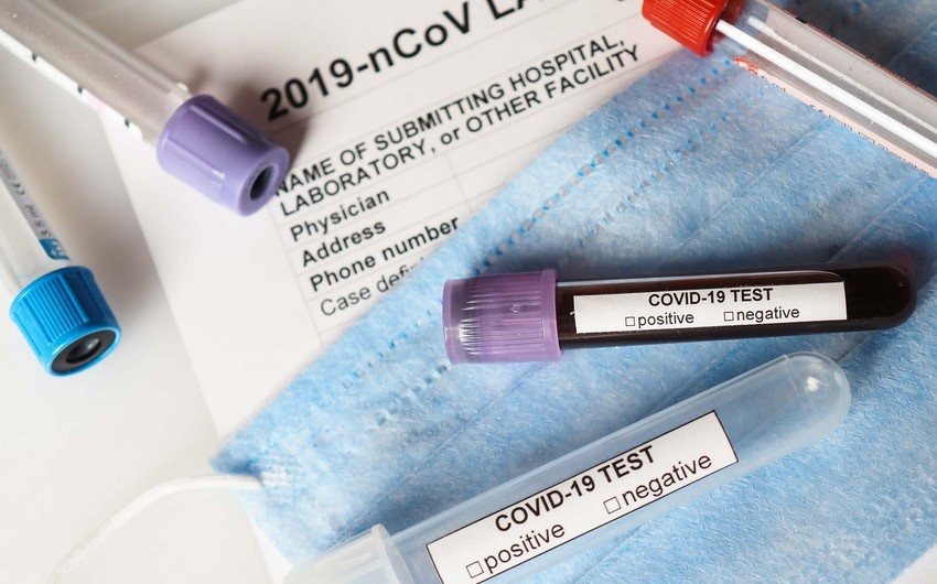 Azərbaycanda son sutkada 12 nəfər koronavirusa yoluxub, ölən olmayıb